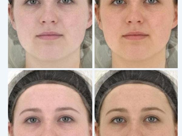 Koža pred in po zelenjavni dieti